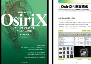OsiriXパーフェクト.gif